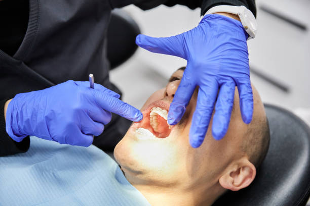 Best Emergency Tooth Extraction in Solvang, CA